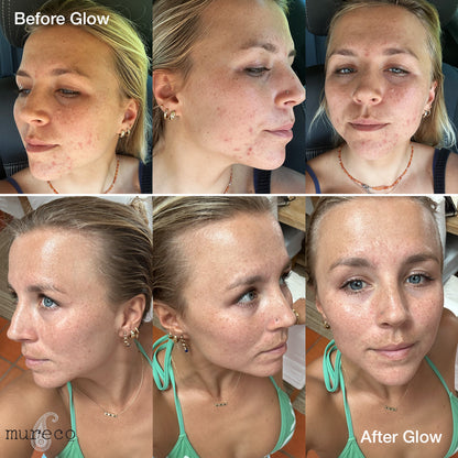 Mureco Glow Oil Before and After