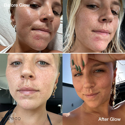 Mureco Glow Oil Before & After